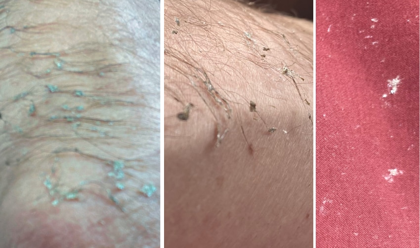 dirty crap from ocean water